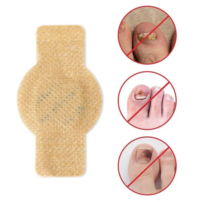 NailRestore – Herstel je nagels zichtbaar van binnenuit
