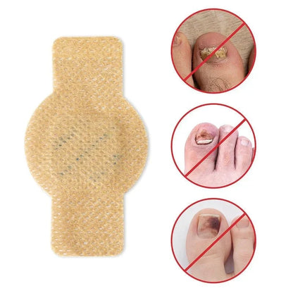 NailRestore – Herstel je nagels zichtbaar van binnenuit