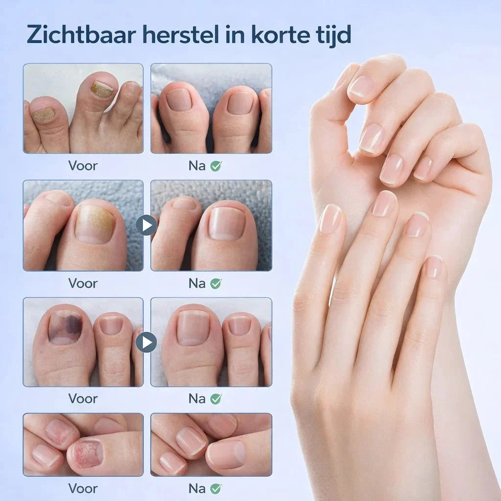 NailRestore – Herstel je nagels zichtbaar van binnenuit
