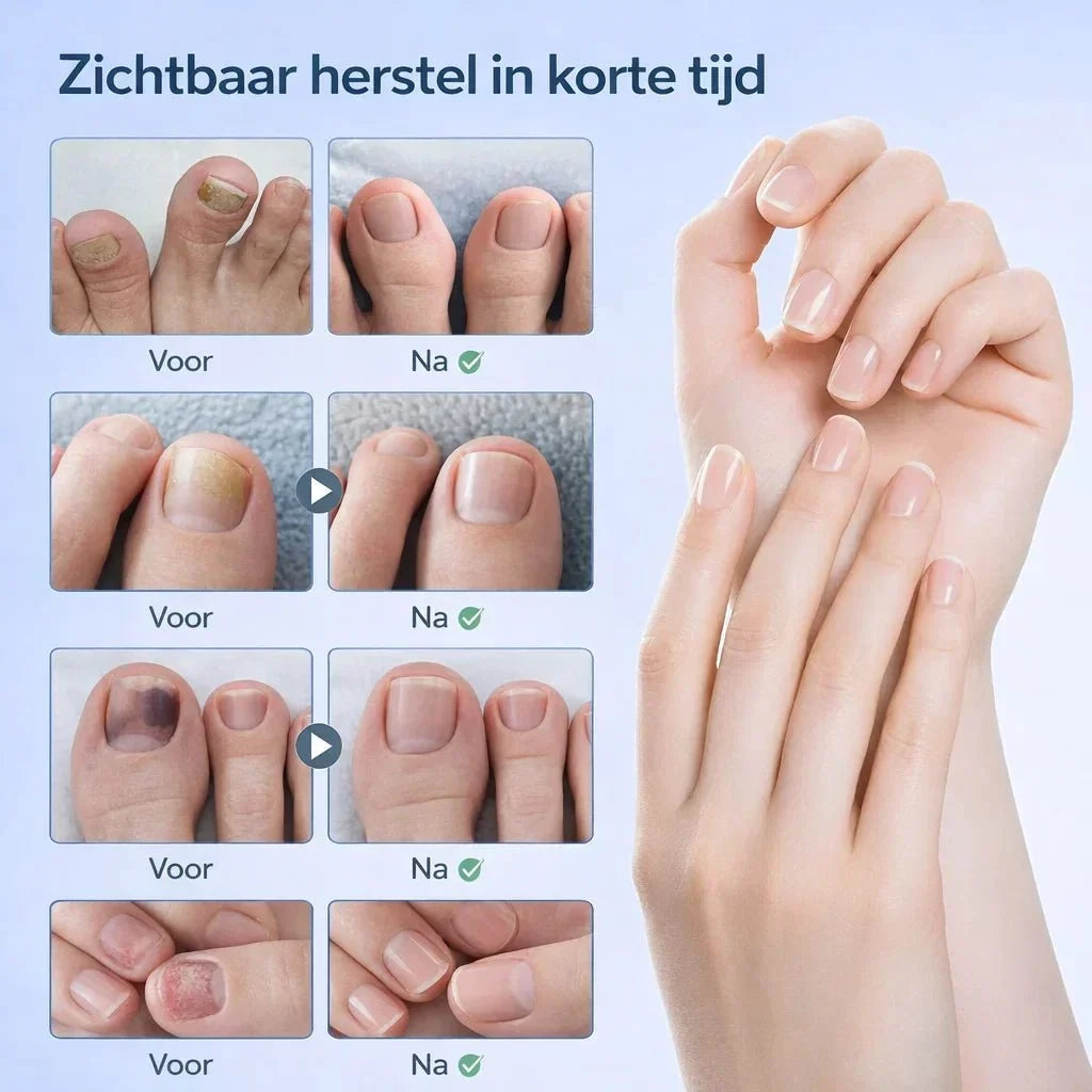 NailRestore – Herstel je nagels zichtbaar van binnenuit