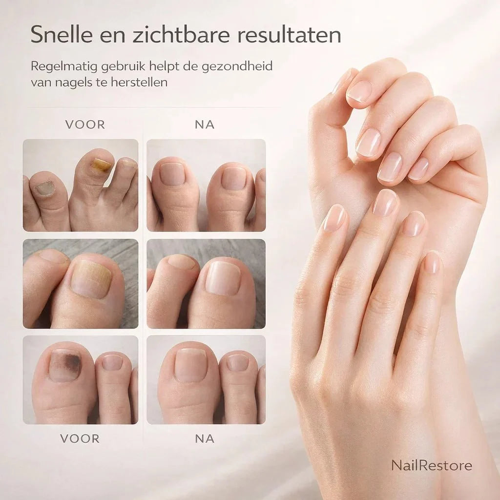 NailRestore – Herstel je nagels zichtbaar van binnenuit