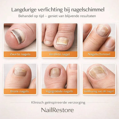 NailRestore – Herstel je nagels zichtbaar van binnenuit