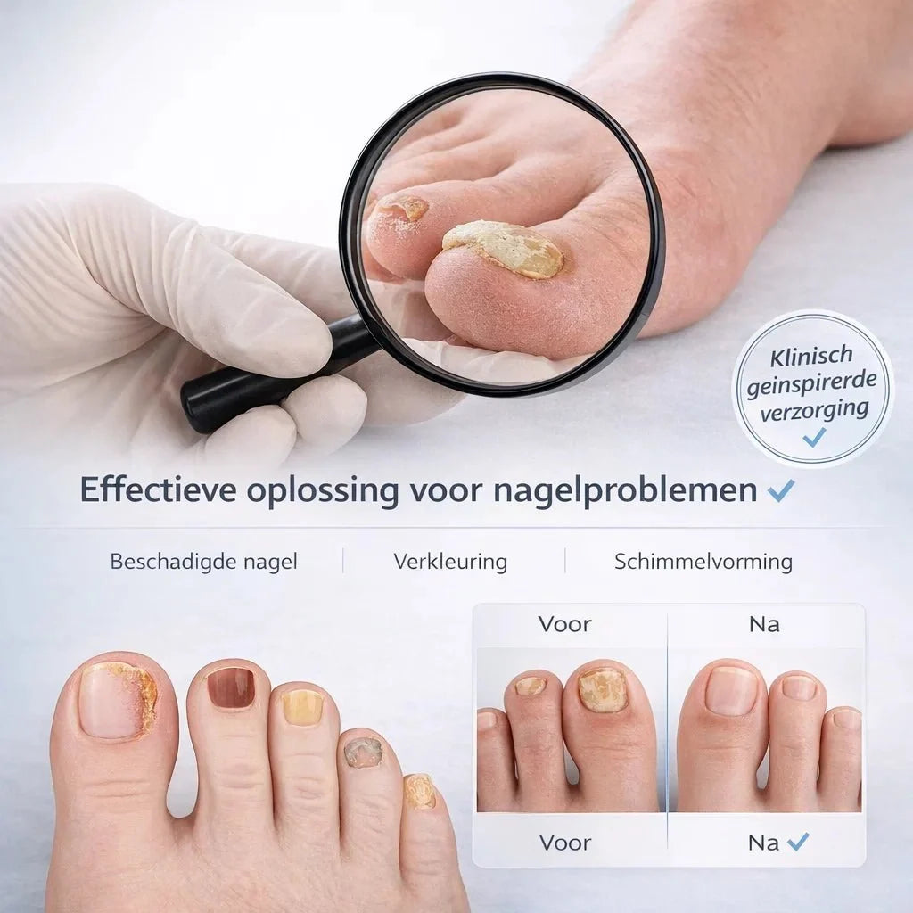 NailRestore – Herstel je nagels zichtbaar van binnenuit